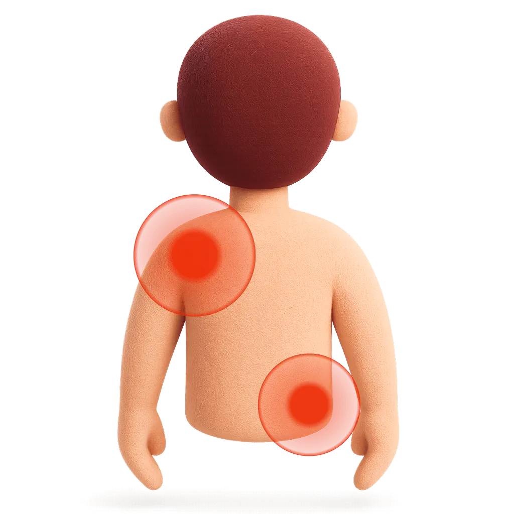 Fisioterapia